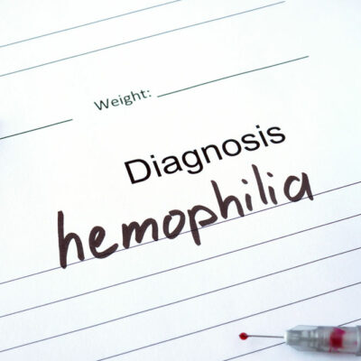 Hemophilia: Symptoms and Treatment Options